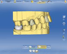 uzmanlar-dentist-digital-dentistry