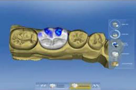 uzmanlar-dentist-digital-dentistry-2