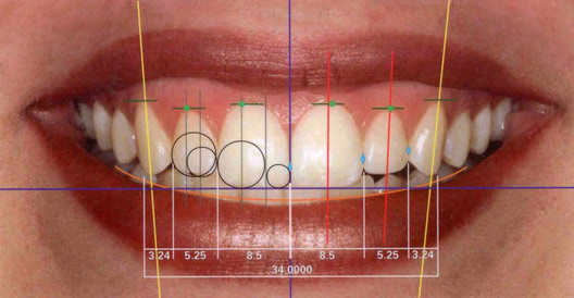uzmanlar_dental_clinic_cosmetic_dentistry