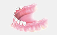 dental implant treatment 5