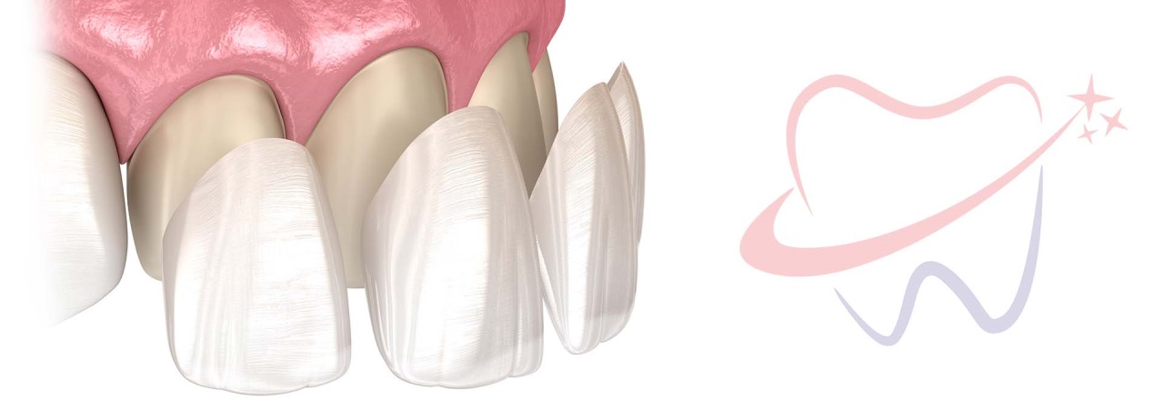 Zirconium Dental Crowns