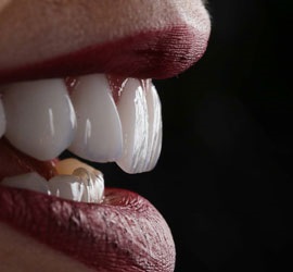 uzmanlar_dental_clinic_treatment_images