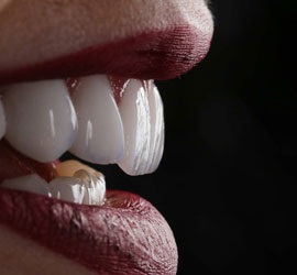 uzmanlar_dental_clinic_treatment_images uzmanlar_dental_clinic_treatment_images