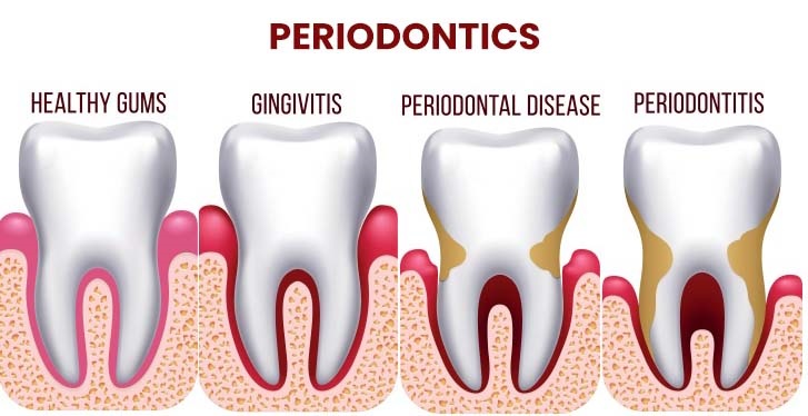 Periodontics