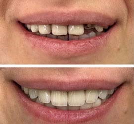 uzmanlar_dental_clinic_treatment_images uzmanlar_dental_clinic_treatment_images