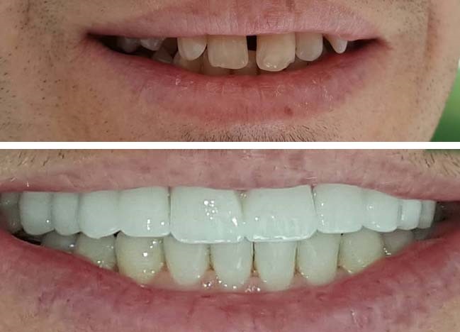 uzmanlar_dental_clinic_treatment_images