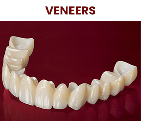 veneer crown treatment in turkey